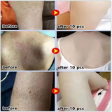 Keratosis Pilaris Repair Treatment Cream Exfoliating Removal Chicken Skin Cleaning Acne Spots Moisturizing Smooth Body Skin Care