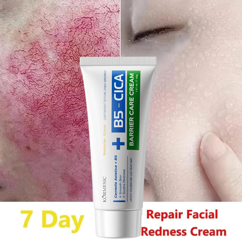 B5 Repair Cream Moisturizing Hydrating Effectively Solves Dry Chapped And Red Skin Nourishes Improve Repair Sunscreen Cream