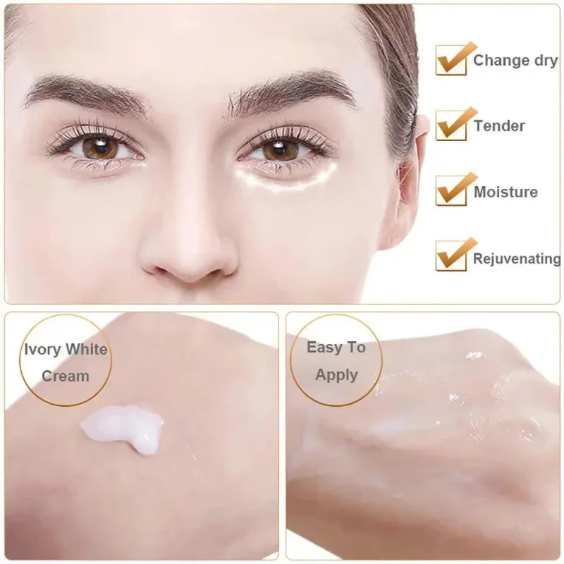 Fat Granules Remover Eye Cream Anti-Puffiness Anti Inflammatory Reduce Dark Circles Eyebags Fade Lines Moisturizing Eye Care