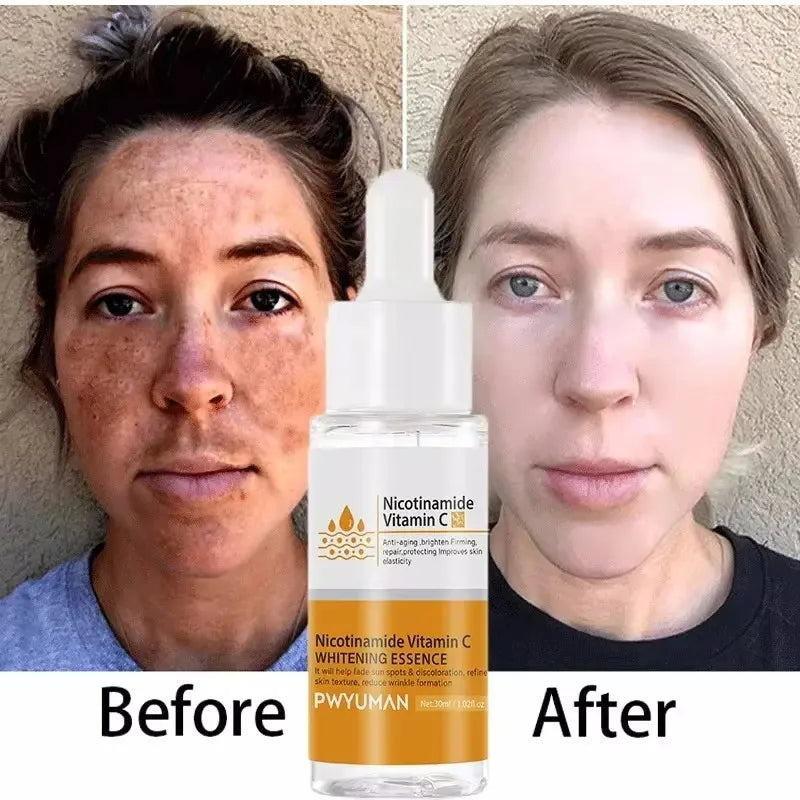 Dark Spots Remover Whitening Face Set Freckle Melanin Correcting Reduce Fine Lines Brighten Essence Korean Beauty Skin Care ﻿