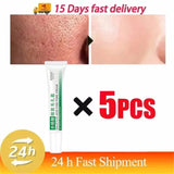 Salicylic Acid Pore Shrinking Cream Quick Elimination Large Pores Remove Blackehead Tighten Face Smooth Skin Korean Care Product