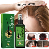 Hair Care Spray Ginger Massage Scalp Improve Dry Damaged Serum Smooth Nourish Repair Roots Anti Hair Loss Essence For Men Women