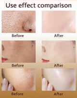 Pore Shrink Face Serum Remove Blackheads Acne Acidity Oil Control Repair Essence Moisturizing Nourish Pores Firming Facial Care