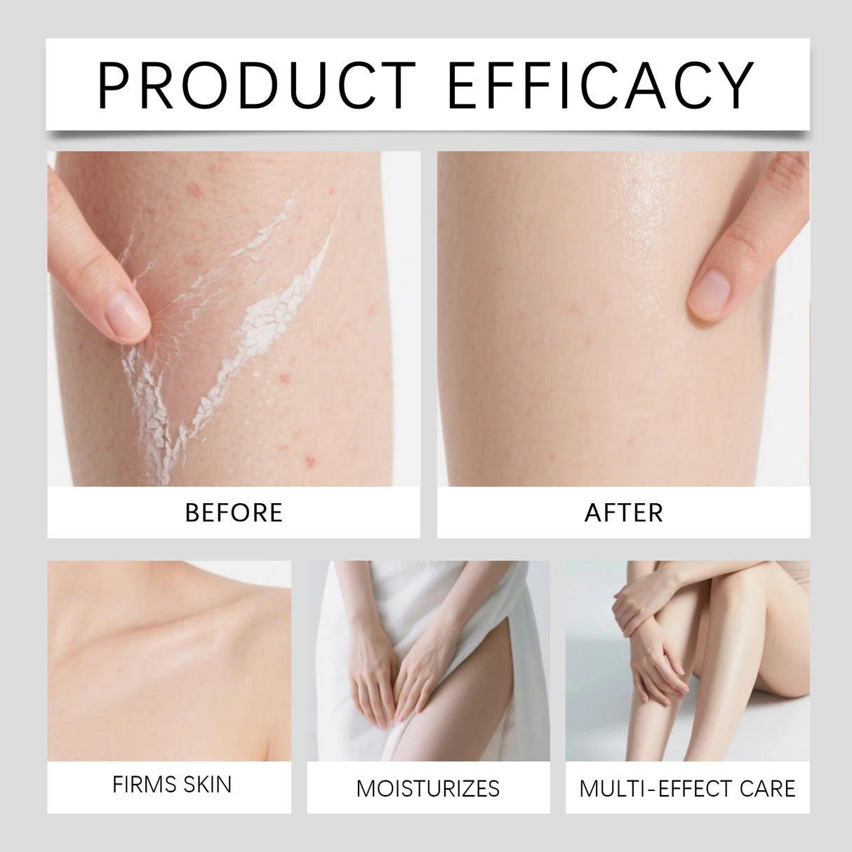 Exfoliating Kojic Acid Turmeric Spray Gently Peeling Solution Hydrating Skin Brightening Mist for Smooth Skin Back & Foot Care