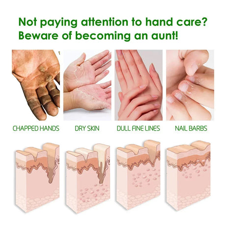 Herbal Anti Crack Foot Cream Heel Cracking Repair Products Exfoliation Dead Skin Removal Softening Moisturize Smooth Skin Care