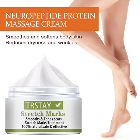 TRSTAY Stretch Mark Scar Repair Cream Enhances Skin Elasticity Moisture Collagen Improvement Safe And Effective