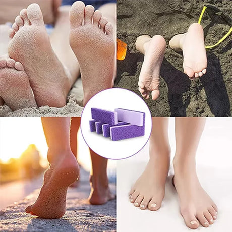 1/10Pcs Foot Care Pedicure Tools Callus Remover Foot Pumice Stone Used to Remove Calluses and Dead Skin from the Feet and Heels