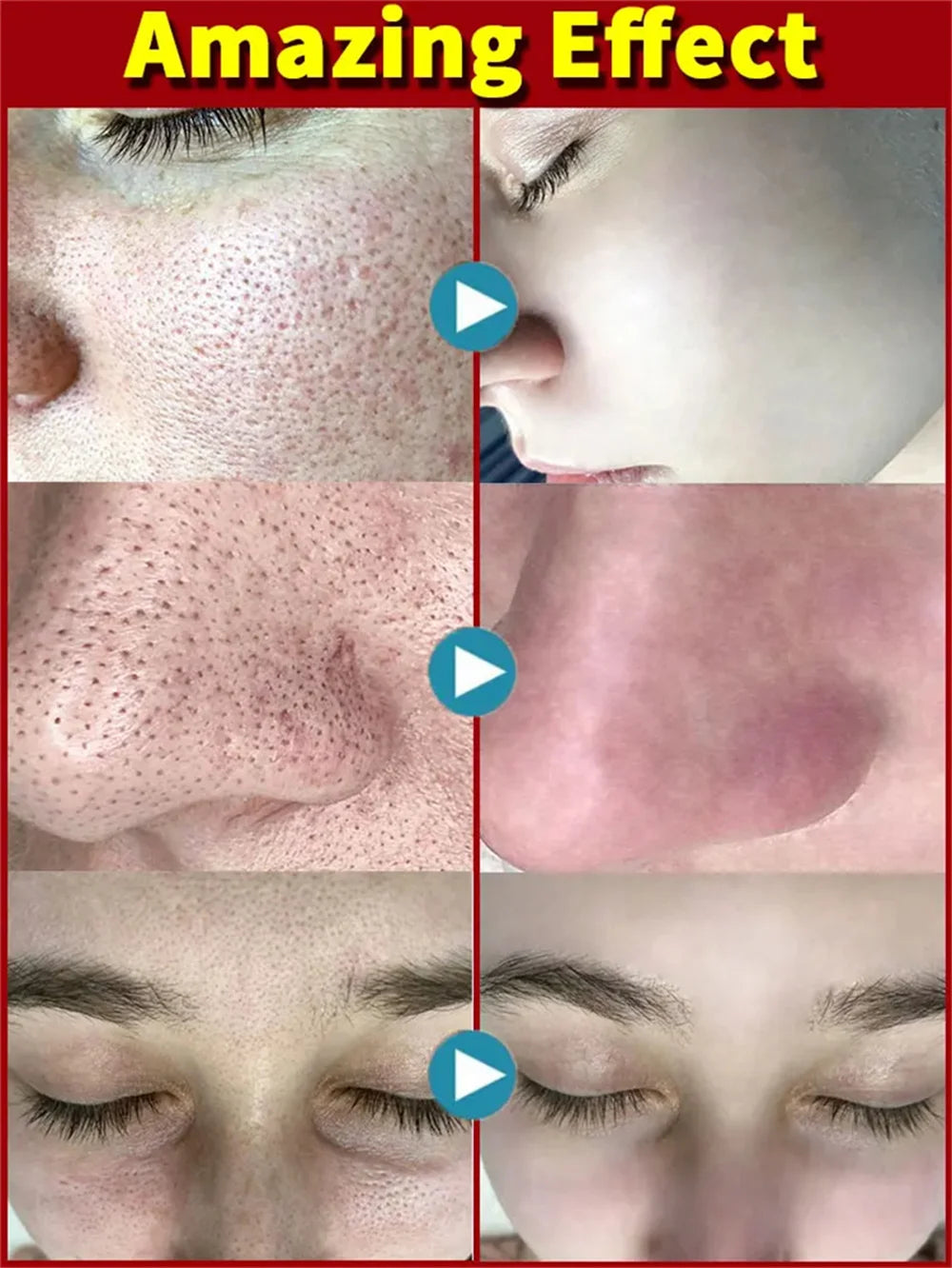 Salicylic Acid Pore Shrinking Cream Quick Elimination Large Pores Remove Blackehead Tighten Face Smooth Skin Korean Care Product