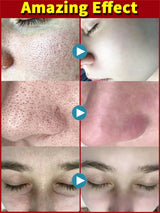 Salicylic Acid Pore Shrinking Cream Quick Elimination Large Pores Remove Blackehead Tighten Face Smooth Skin Korean Care Product