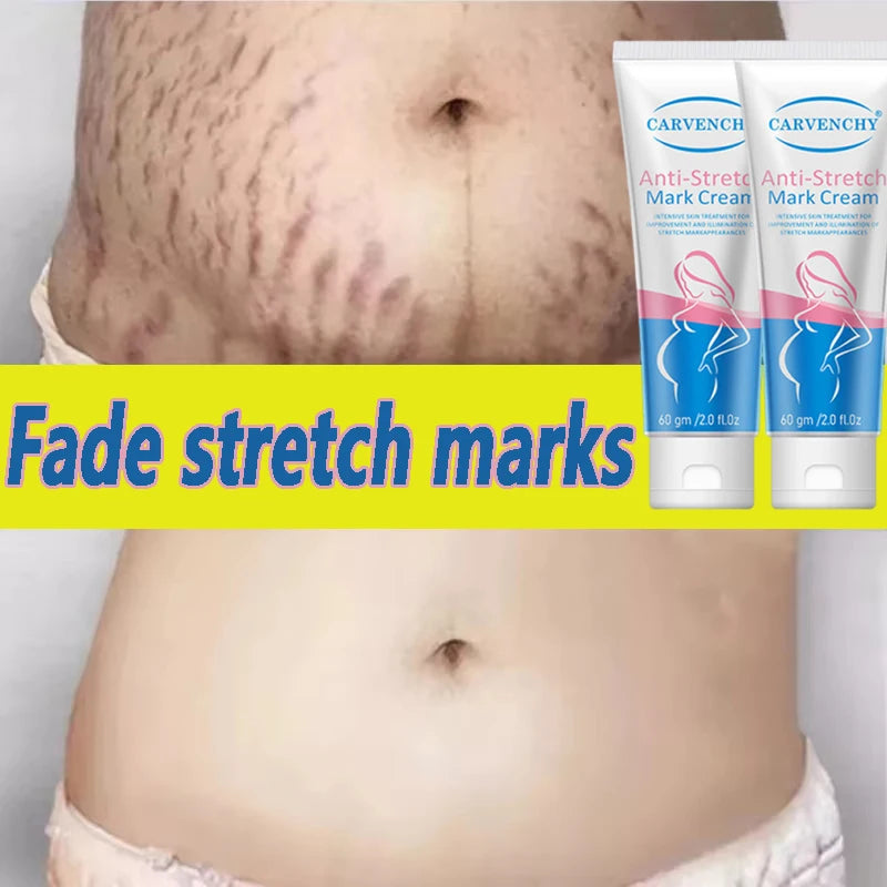Snail Removes Stretch Mark Cream To Remove Postpartum Obesity Pregnant Women Repair Anti-Aging Anti-Winkles Firming Body Cream