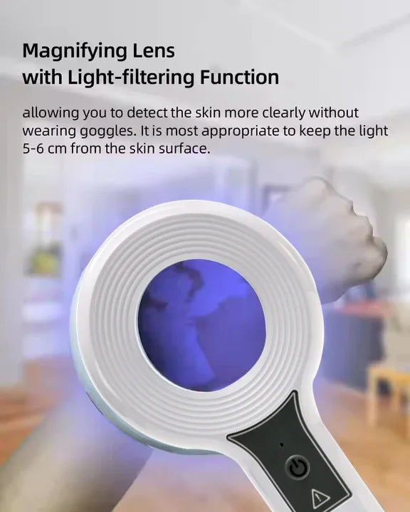NEW Professional Dermatoscope Skin Medical Magnifier Detection Woods Lamp UVA Lamp For Vitiligo Detection