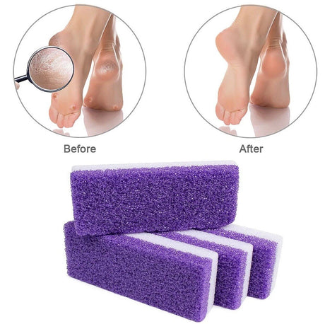 Premium Foot Care Set – Dual-Sided Foot File & Natural Pumice Stone for Smooth, Soft Heels