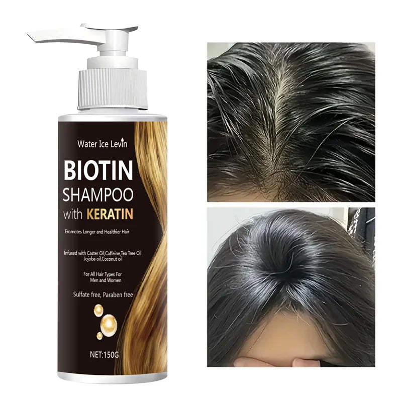 Water Ice Levin Biotin & Keratin Shampoo, Sulfate/Paraben Free, With Nourishing Oils, For Longer Healthier Hair, All Hair Types