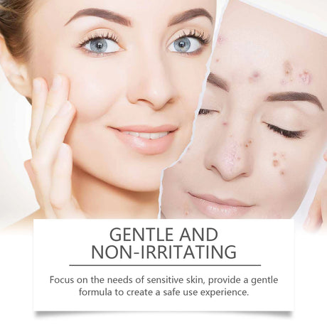 Salicylic Acid Facial Cleanser Acne Treatment Moisturizing Oil Control Skincare Face Wash Cleansing Pore Hydrating Skin Care