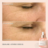 Squalane + Vitamin C Rose Advanced Facial Oil - Brightening, Firming, and Hydrating Serum for All Skin Types