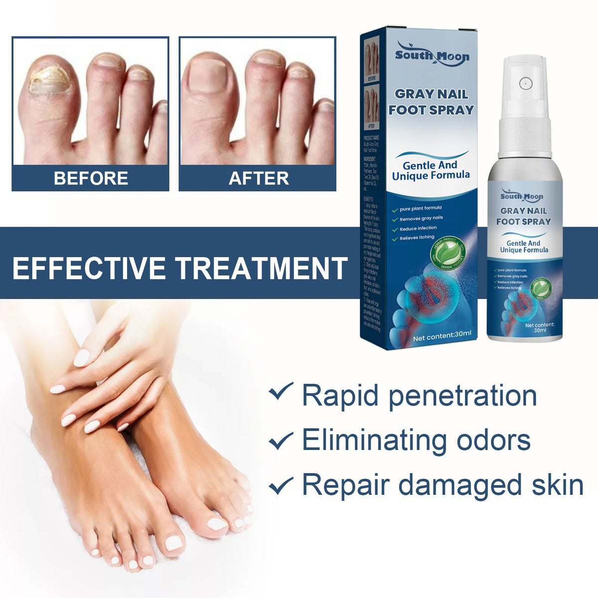 South Moon Foot Spray Anti Smell Remove Toenail Fungal Paronychia Onychomycosis Care Deodorant Antiperspirant Nail Repair Spray