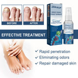 South Moon Foot Spray Anti Smell Remove Toenail Fungal Paronychia Onychomycosis Care Deodorant Antiperspirant Nail Repair Spray