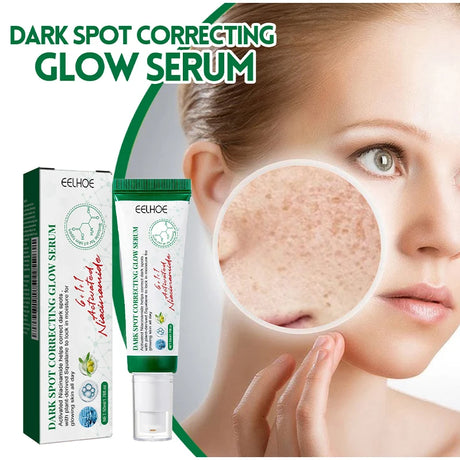 Dark Spot Correcting Glow Serum,Dullness,Acne,And Melanin Remover,Niacinamide Facial Skin Moisturizing Brightening Skincare