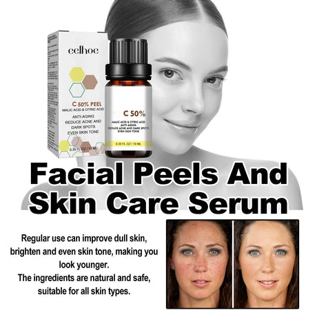 High Quality 50% Chemical Peel Acid Skin Superforce Pigmentation Lightening Melanin Acne Treatment Remove Scar