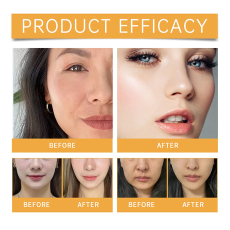 Wrinkle Removal Patch Hyaluronic Nasolabial Folds Face Lifting Sticker Firming Forehead Fine Lines Gel Anti-Aging Collagen Mask