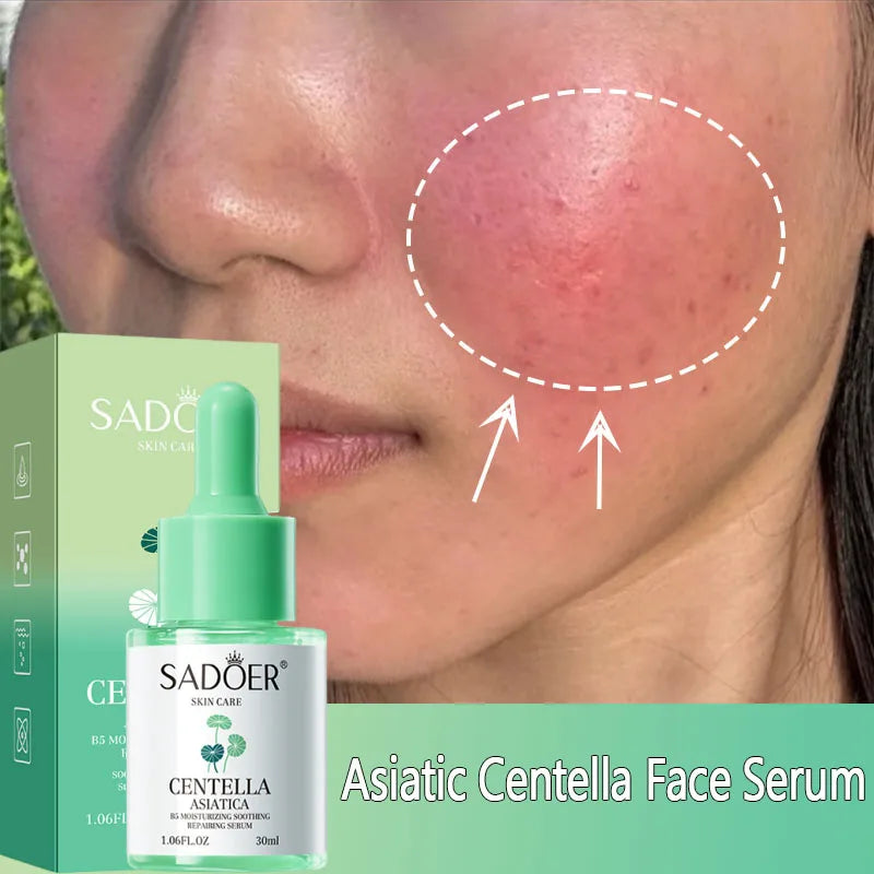 Asiatic Centella Face Serum Reduce Facial Redness Lifting Firming Faded Wrinkles Whitening Facial Essence Skin Care Product