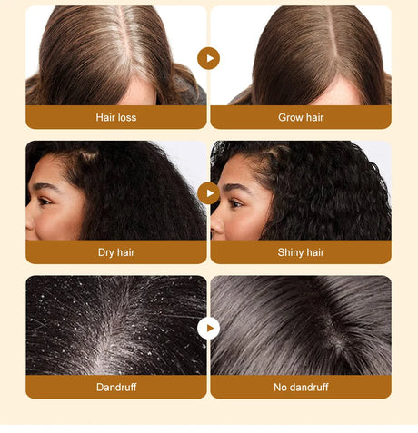 Batana Oil Hair Growth Products Fast Growth Batana Essence Oil Traction Alopecia Anti Hair Loss Baldness Treatment For Men Women