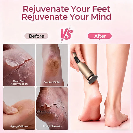 Aluminum Alloy 2-in-1 Electric Callus Remover And Food Grinder Hand Foot Care Tool Set with Gift Box