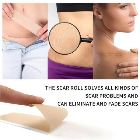 Silicone Scar Sheets - Reusable Scar Tape for Keloid, C-Section, Surgery, Burn, Acne - Waterproof, Hypoallergenic, Latex-Free