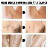 Men's Hair Removal Cream Nourishing Painless Non-Irritating Growth-Inhibiting Smooth Portable Body Hair Removal Lotion