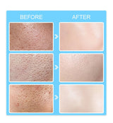 Salicylic Acid Pore Shrinking Cream Quick Elimination Large Pores Remove Blackehead Tighten Face Smooth Skin Korean Care Product