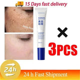 Powerful Spot-Removing Whiten Cream Brighten Skin Fast Eliminates Melanin Pigmentation Melasma Dark Spots Korean Face Skin Care