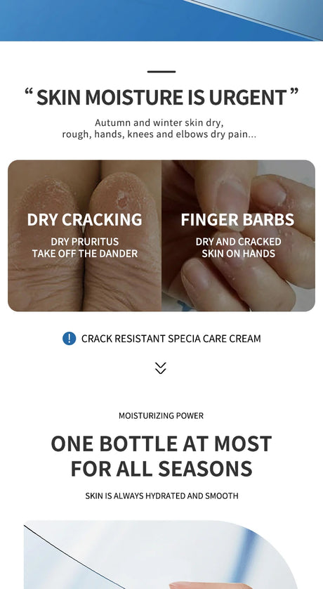 Anti Crack Foot Cream For Dry And Cracked Feet And Heels, Moisturizing Dry Feet And Heels, Preventing Your Feet From Cracking